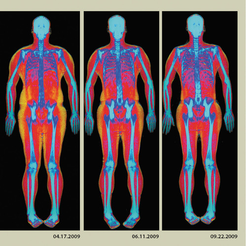 Body Composition Scan - Center for Reproductive Medicine and Robotic Surgery